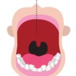 Quand est-il nécessaire pour l’enfant de voir un orthodontiste ?