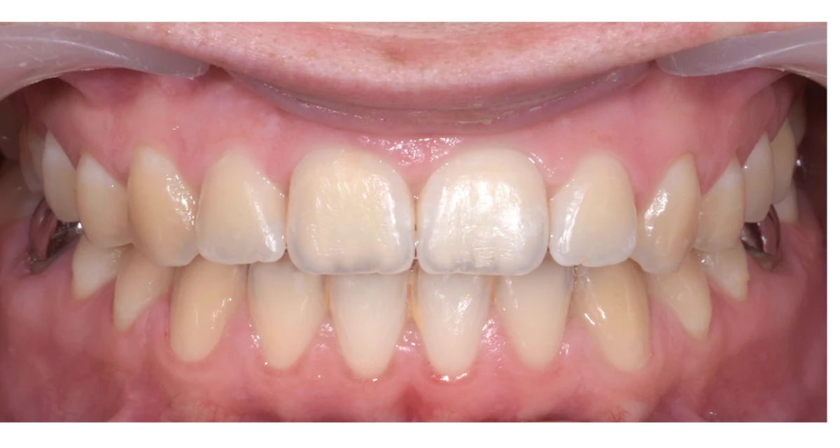 Cas cliniques d’orthodontie 