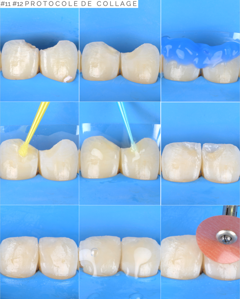 Soirées Study Group à Cannes