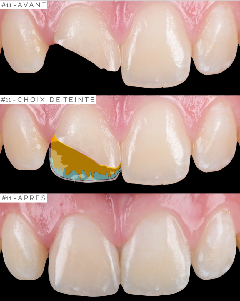 Soirées Study Group à Cannes
