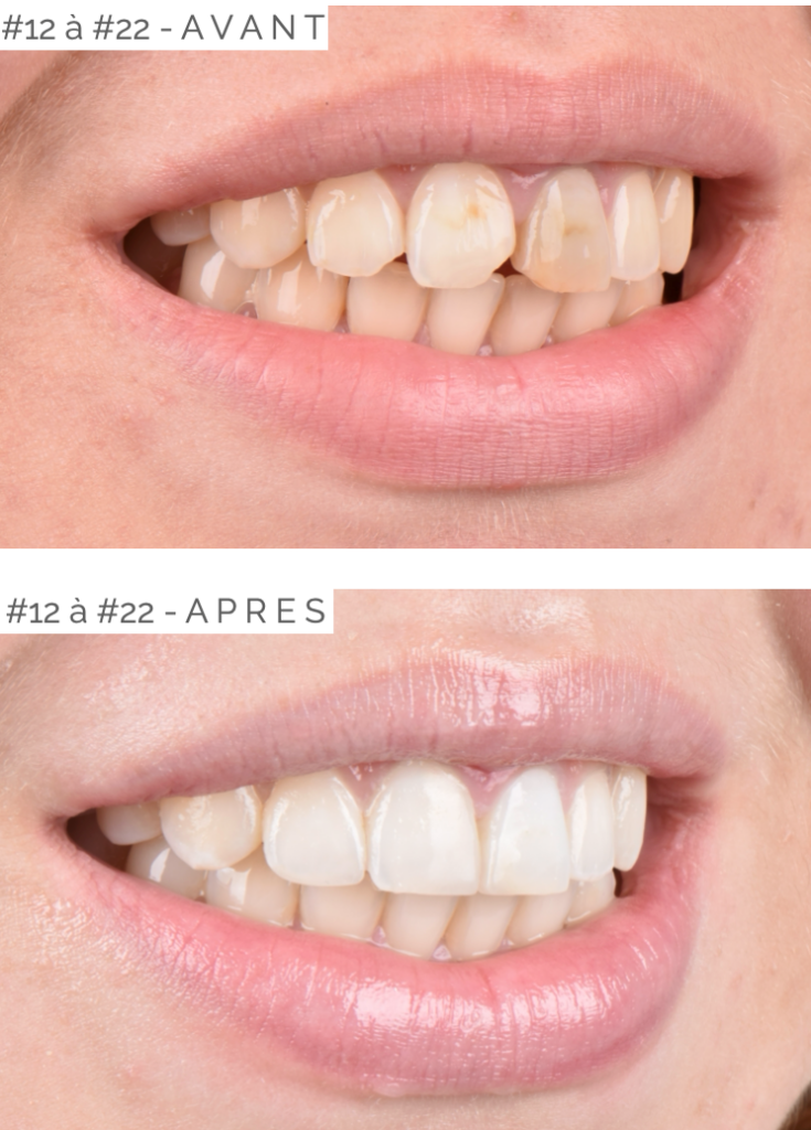 Soirées Study Group à Cannes