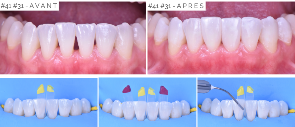 Soirées Study Group à Cannes