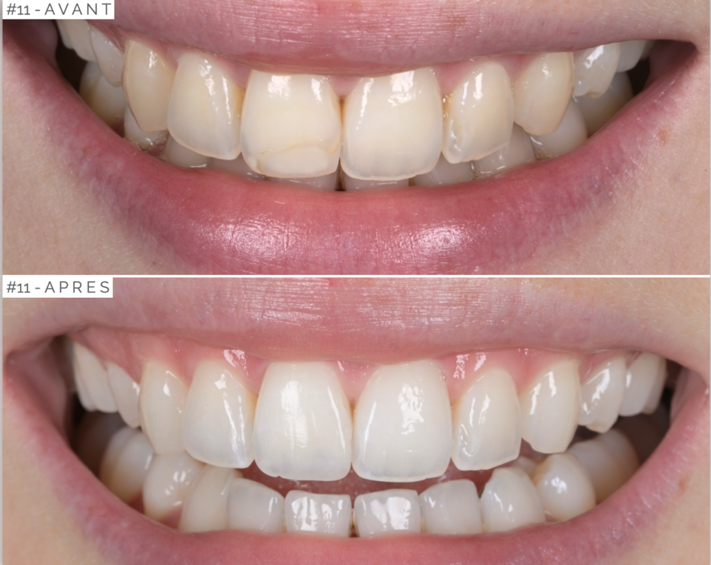 Soirées Study Group à Cannes