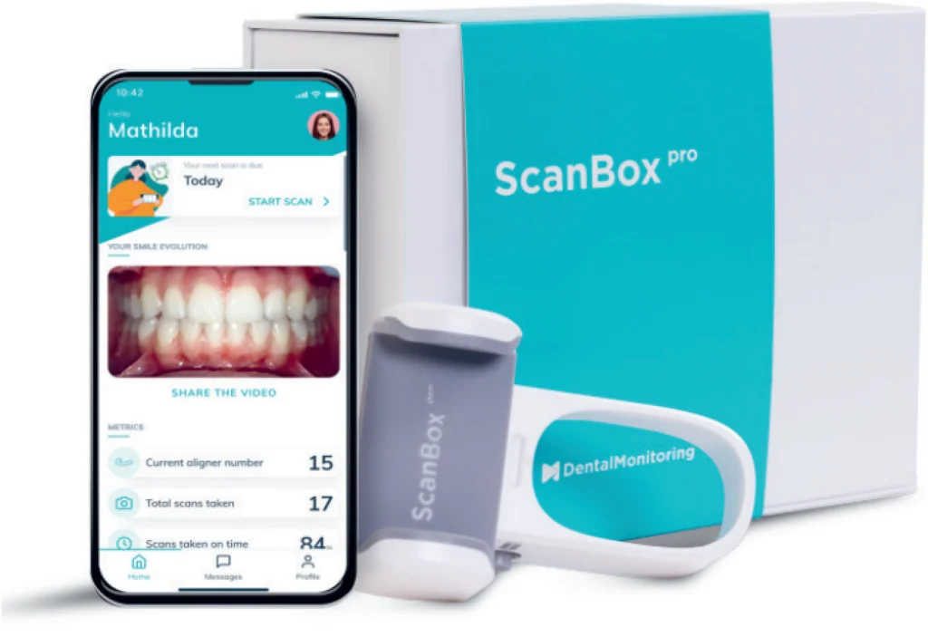LE SUIVI DE VOTRE TRAITEMENT AVEC DENTAL MONITORING