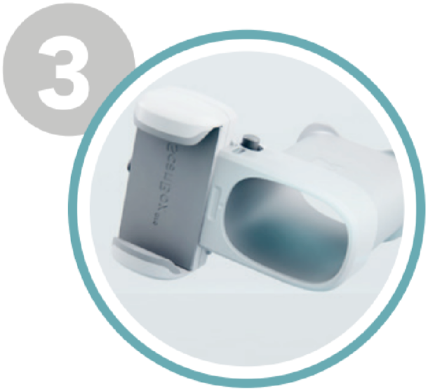 LE SUIVI DE VOTRE TRAITEMENT AVEC DENTAL MONITORING