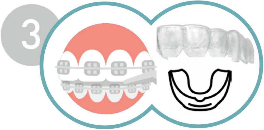 5 ÉTAPES POUR UN SOURIRE PARFAIT