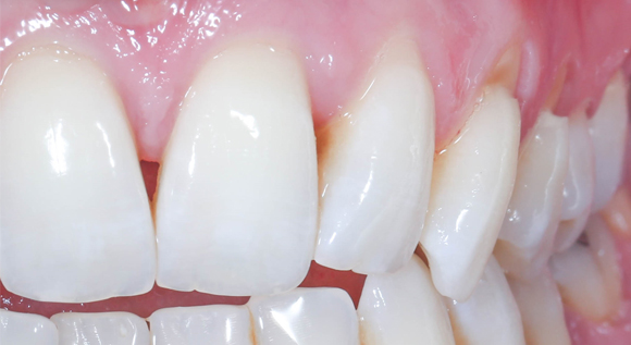 Soirées Study Group à Cannes