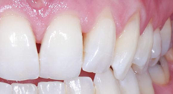 Soirées Study Group à Cannes