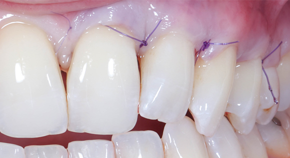 Soirées Study Group à Cannes